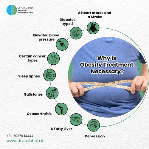 Why is Obesity Treatment Necessary.jpg