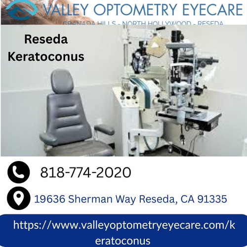 Reseda Keratoconus (1).jpg