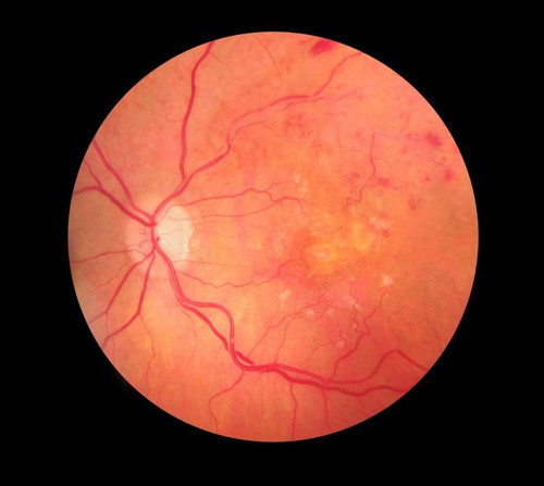 Ophthalmologist.jpg