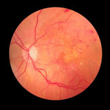 Ophthalmologist