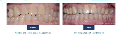dental.png