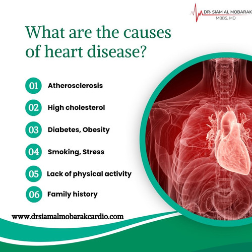 dr siam causes of heart disease.jpg