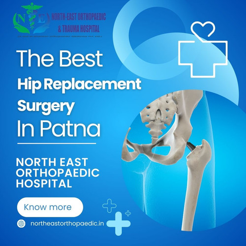 Best Hip Replacement Surgery in Patna – North East Orthopaedic Hospital.jpg