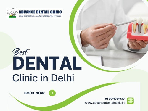 Best Dental Clinic in Delhi - Advance Dental Clinic.jpg