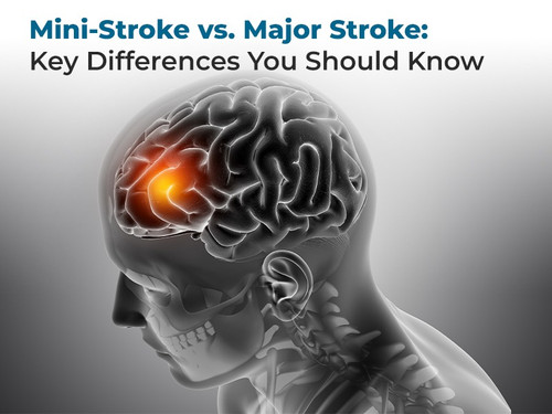 Mini Stroke vs. Major Stroke Key Differences You Should Know.jpg