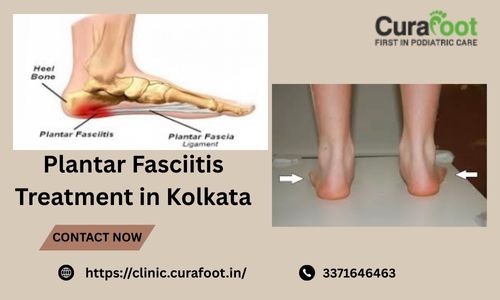 Treatment of Plantar Fasciitis in Kolkata by Skilled Physicians.jpg