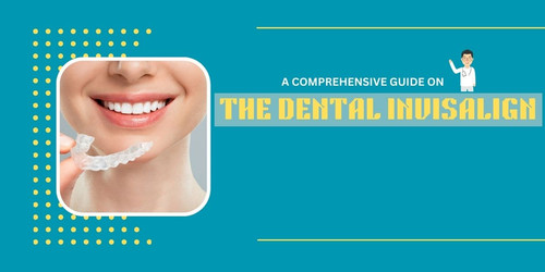 A COMPREHENSIVE GUIDE ON THE DENTAL INVISALIGN.jpg
