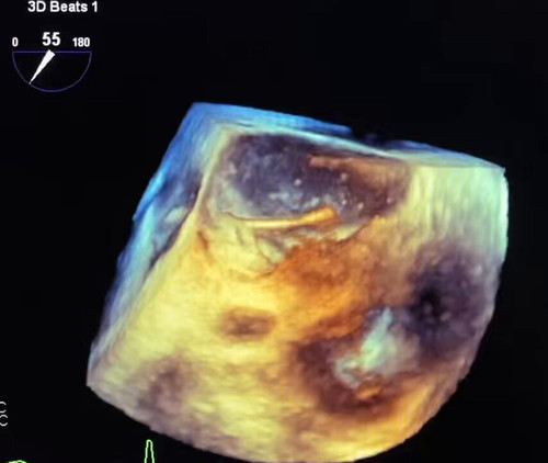 3dSLPc4iaBABQfX .jpg