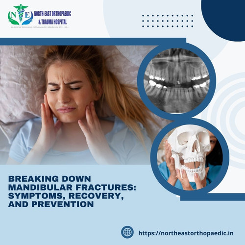 Breaking Down Mandibular Fractures: Symptoms, Recovery, and Prevention.jpg