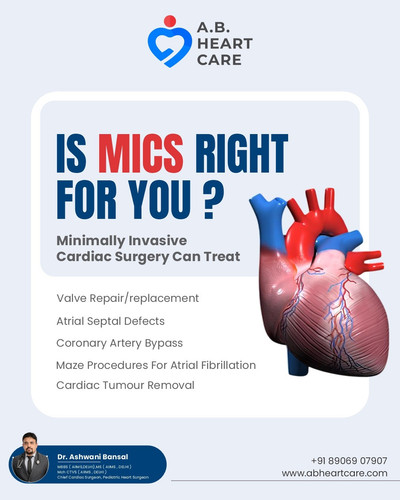 Minimally Invasive Cardiac Surgery Chandigarh ab.jpg
