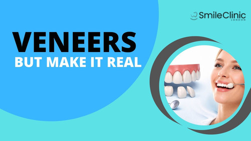 VENEERS, BUT MAKE IT REAL WHAT THEY ACTUALLY ARE.jpg