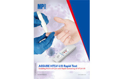 ASSURE HTLV I II Rapid Test.jpg