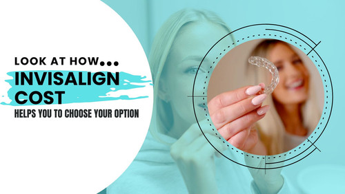 Look at How Invisalign Cost Helps You to Choose Your Option.jpg