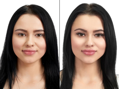 Best PRP facial rejuvenation.jpg