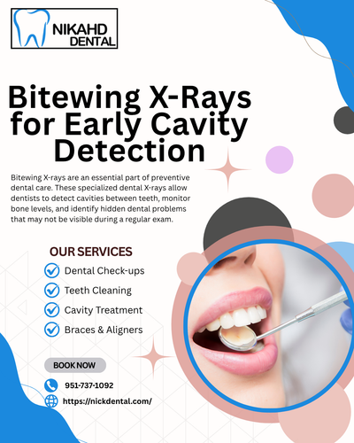 Bitewing X-Rays for Early Cavity Detection | Nikhad Dental Clini.png