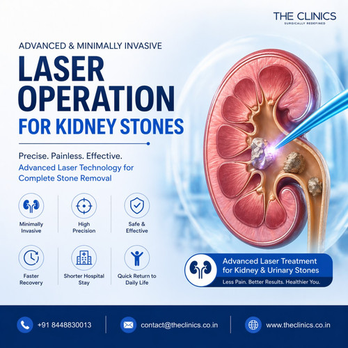Advanced Laser Operation for Kidney Stones | Safe & Painless Treatment.jpg
