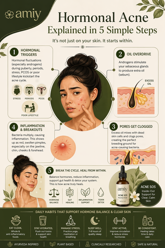 Hormonal Acne Explained in 5 Simple Steps.png