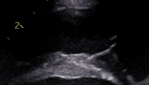 1884 image crop 300 100 700 400.png