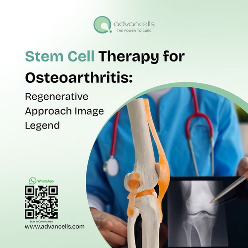 Stem Cell Therapy for Osteoarthritis (1).jpg