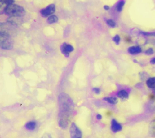 1093 image crop 200 200 500 500.jpg