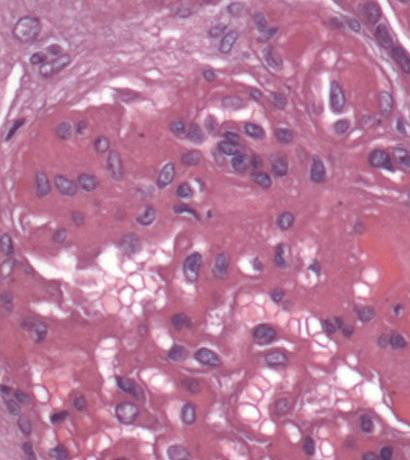 2350 image crop 300 200 700 800.jpg