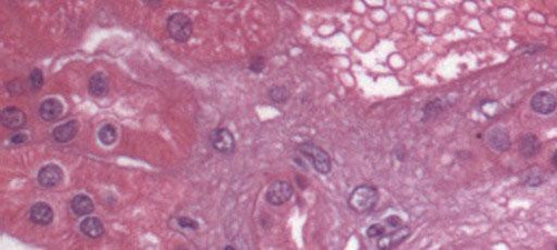 2350 image crop 0 0 300 500.jpg