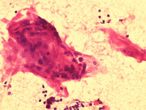 1092 image crop 100 100 800 800.jpg