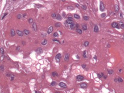 2350 image crop 300 300 700 700.jpg