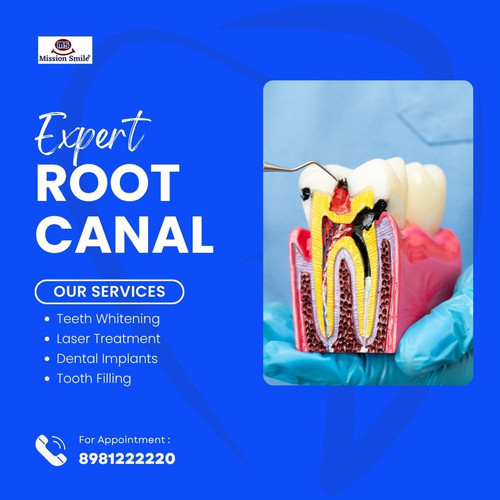 Expert Root Canal Treatment in Kolkata for Quick Relief from Tooth Pain.jpg