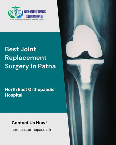 Best Joint Replacement Surgery in Patna: North East Orthopaedic Hospital.jpg