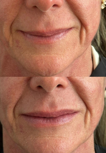 before after 1 DLCZcAGg.jpg