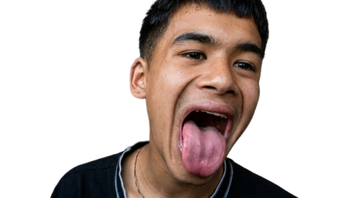 temp.png