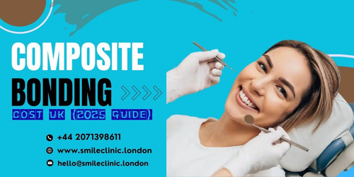 COMPOSITE BONDING COST UK (2025 GUIDE).jpg