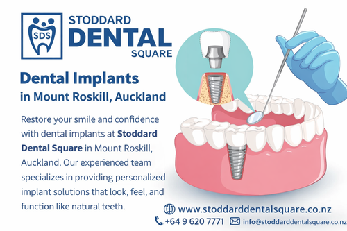 Dental Implants in Mount Roskill, Auckland.png