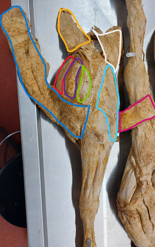 eb7d2e18c519.jpg