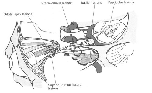 845de86f88b5.jpg