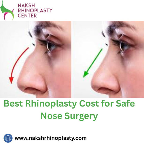 Best Rhinoplasty Cost for Safe Nose Surgery.jpg