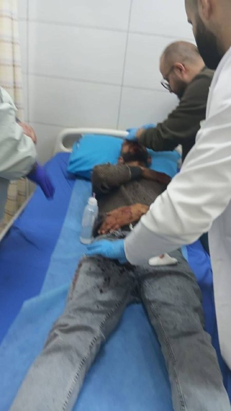 مستوطنون يعتدون على شاب من بلدة بني نعيم شرق محافظة الخليل، حيث تم نقله لتلقي العلاج....