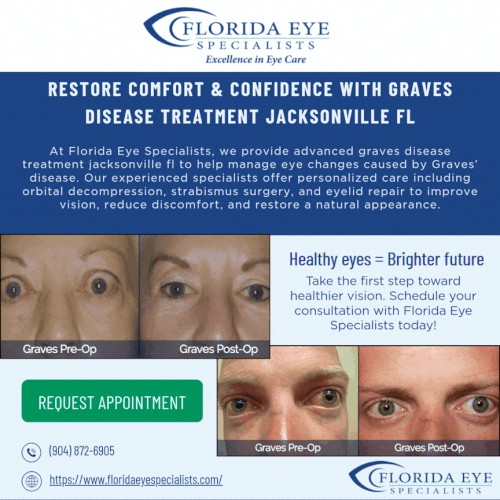 Florida Eye Specialists – Graves Disease Treatment Jacksonville FL for Clearer, Healthier Vision (Ma.gif