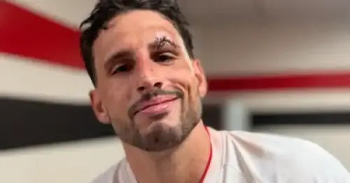 Calleri recebe 8 Pontos na sobrancelha após choque durante confronto São Paulo x Cruzeiro