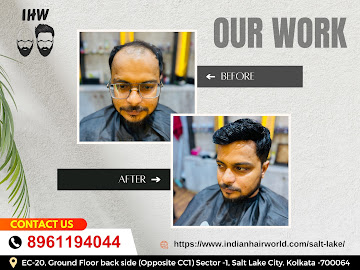 Best hair patch center Kolkata | Indian Hair World.jpg