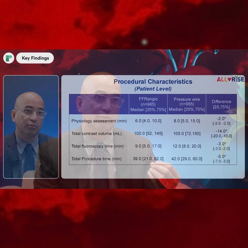 k0g2 euxe 4H33dK.jpg