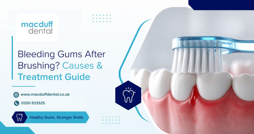 Bleeding Gums After Brushing? Know the Causes & Fix It Fast.jpg