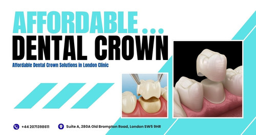 Affordable Dental Crown Solutions in London Clinic.jpg