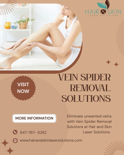 Say Goodbye to Visible Veins with Spider Removal Solutions.png