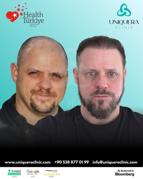 Best Hair Transplant Clinic in Turkey – Uniquera Clinic.jpg