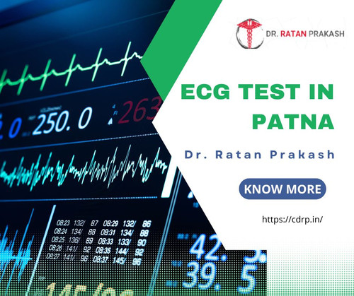 Best ECG Test in Patna: Dr. Ratan Prakash.jpg