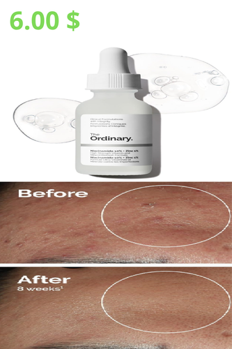 The Ordinary Niacinamide 10% 1.png