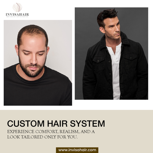 Custom Hair System.png