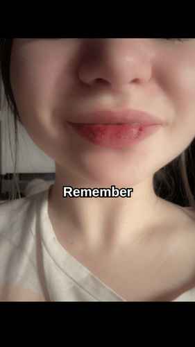 cf14035d5173.png